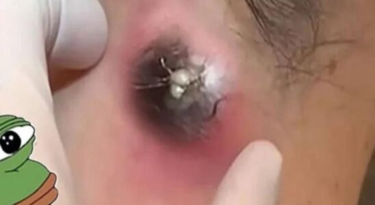 What Can Happen to Your Body If You Drink Coffee in the Morning