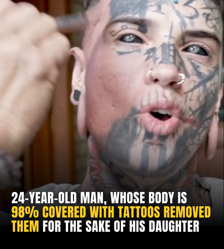 24-Year-Old Man With A Lot Of Tattoos Gets Rid Of Them For His Daughter