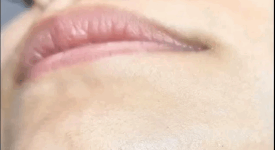 Why Chin Hair Grows: What Science Says