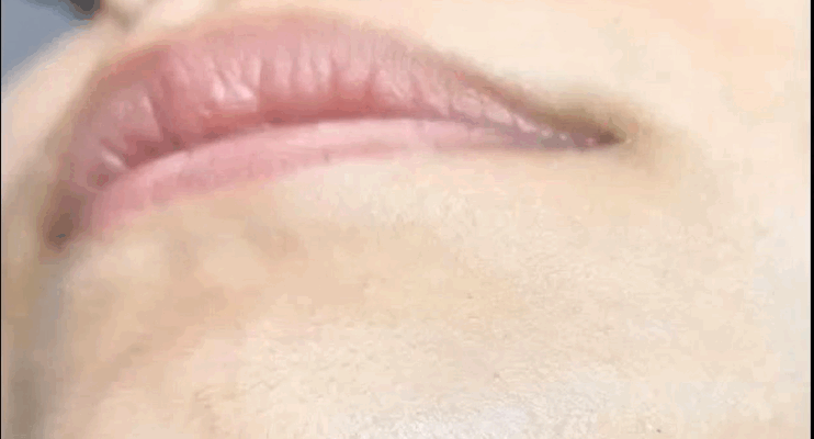 Why Chin Hair Grows: What Science Says