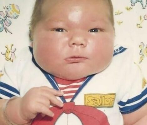 The 16-Pound Baby from 1983: See Him Now