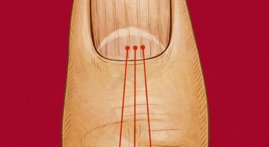 What Vertical Lines on Your Nails Can Reveal About Aging
