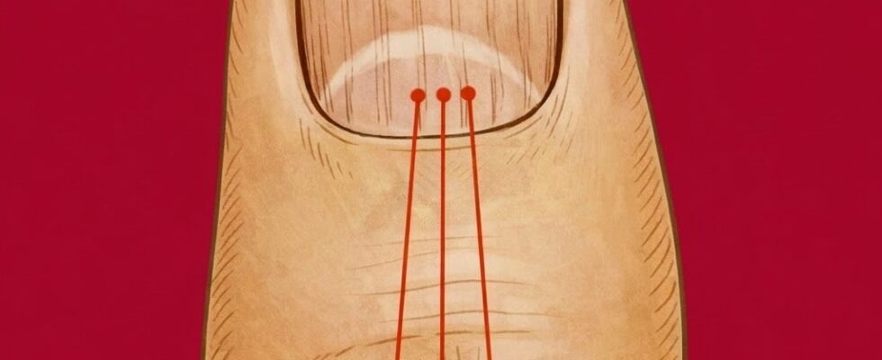 What Vertical Lines on Your Nails Can Reveal About Aging